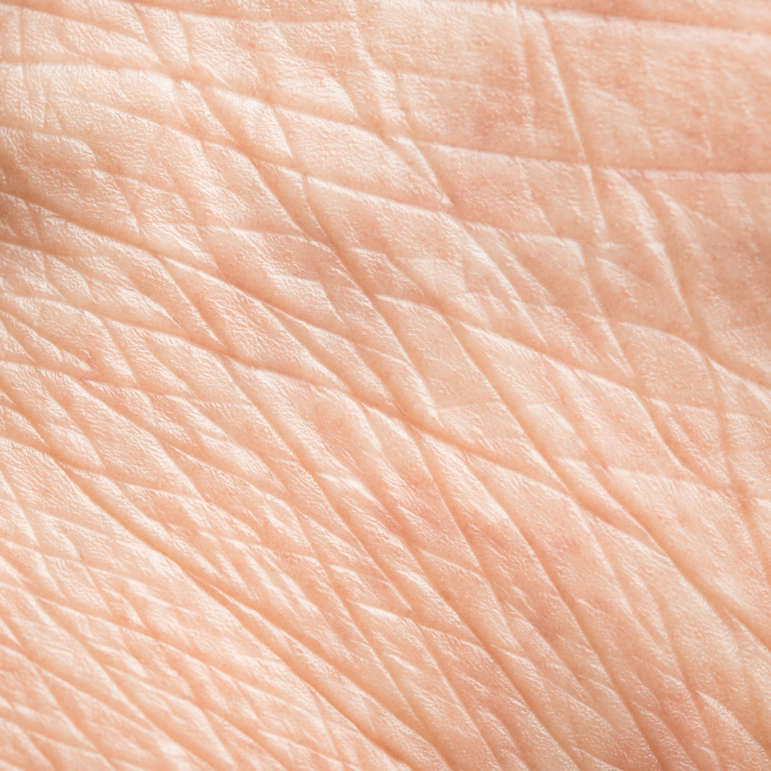 Mature skin skin condition